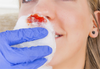 5 Things You Learn When Your Body Can't Stop Bleeding