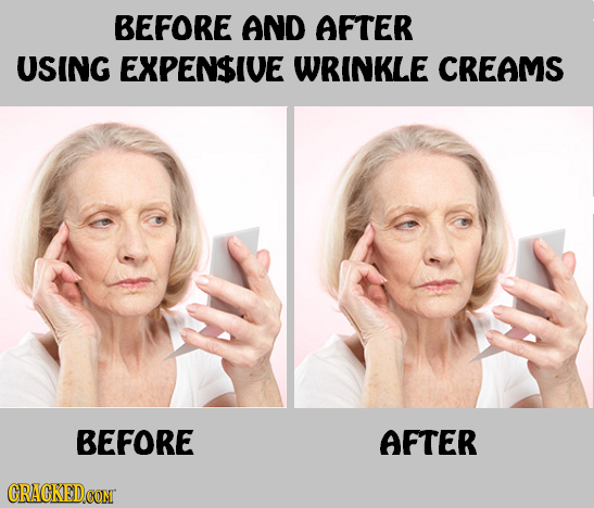 BEFORE AND AFTER USING EXPENSIVE WRINKLE CREAMS BEFORE AFTER
