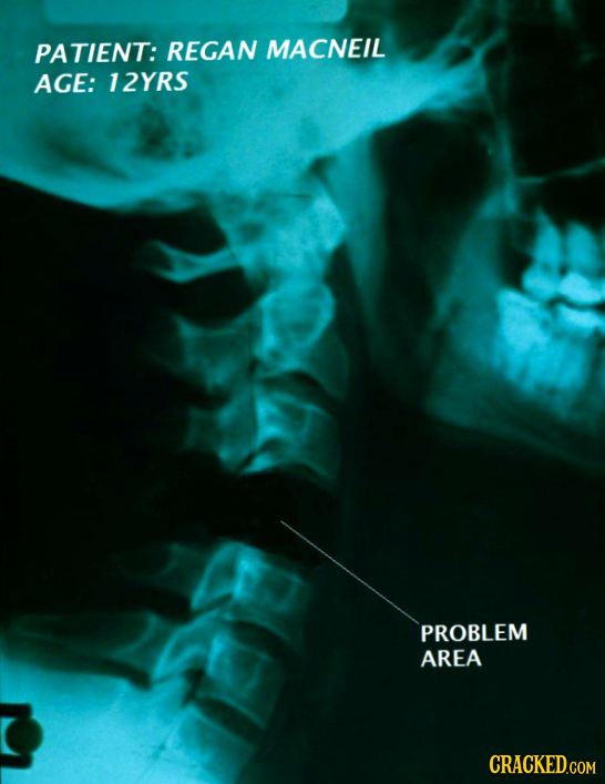 PATIENT: REGAN MACNEIL AGE: 12YRS PROBLEM AREA