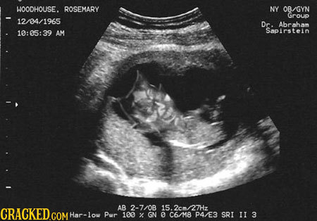 HOODHOUSE. ROSEMARY NY OB/GYN Group 12/04/1965 Dr. Abrabam 10:05:39 AM Sapirsteln WV AB CRACKEDGOM 2-7/08 15.2cm/27Hz Har-low Pur 100 % GN 0 C6/M8 P43