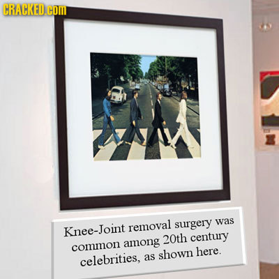 CRACKED.COM surgery was Knee-Joint removal 20th century among common shown here. celebrities, as 