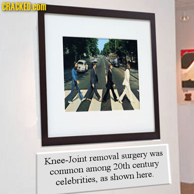 CRACKED.COM surgery was Knee-Joint removal 20th century among common shown here. celebrities, as