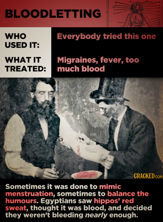 BLOODLETTING WHO Everybody tried this one USED IT: WHAT IT Migraines, fever, too TREATED: much blood CRACKEDco Sometimes it was done to mimic menstrua