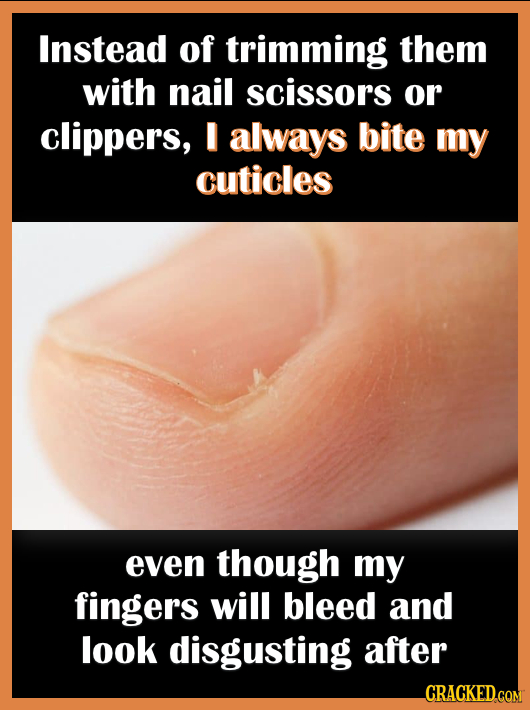 Instead of trimming them with nail scissors or clippers, I always bite my cuticles even though my fingers will bleed and look disgusting after _CRACKE