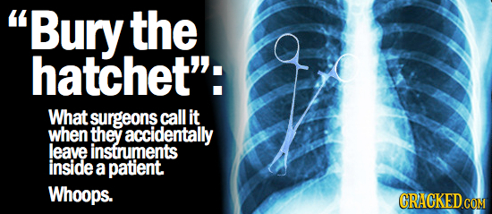 Bury the hatchet'': What surgeons call it when they accidentally leave instruments inside a patient Whoops.