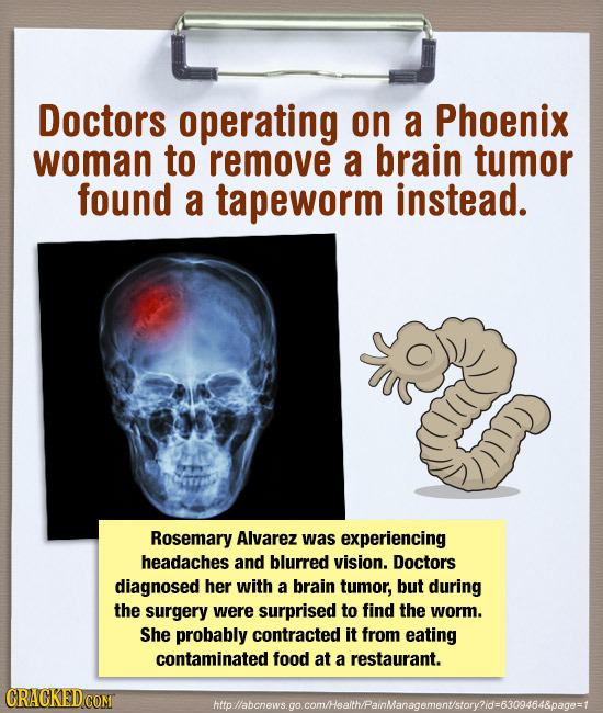 Doctors operating on a Phoenix woman to remove a brain tumor found a tapeworm instead. Rosemary Alvarez was experiencing headaches and blurred vision.