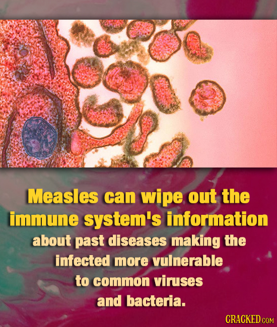 Measles can wipe out the immune system's information about past diseases making the infected more vulnerable to common viruses and bacteria. CRACKED C