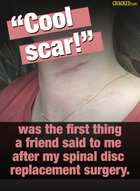 Cool scar! was the first thing a friend said to me after my spinal disc replacement surgery.