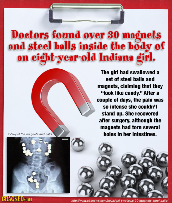 Doctors found over 30 magnets and steel balls inside the body of an eight-year-old Indiana girl. The girl had swallowed a set of steel balls and magne