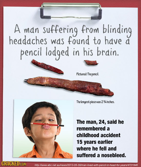 A man suffering from blinding headaches was found to have d pencil lodged in his brain. Pictured: The pencil. Thelongest piece was 3/inches. The man,