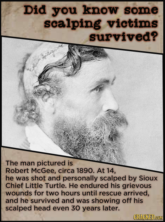 Did you know some scalping victims survived? The man pictured is Robert McGee, circa 1890. At 14, he was shot and personally scalped by Sioux Chief Li