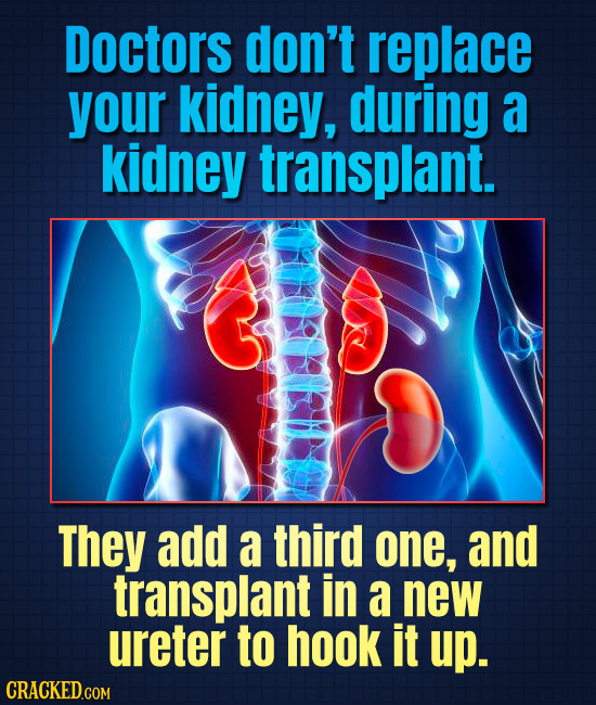 Doctors don't replace your kidney, during a kidney transplant. They add a third one, and transplant in a new ureter to hook it up.