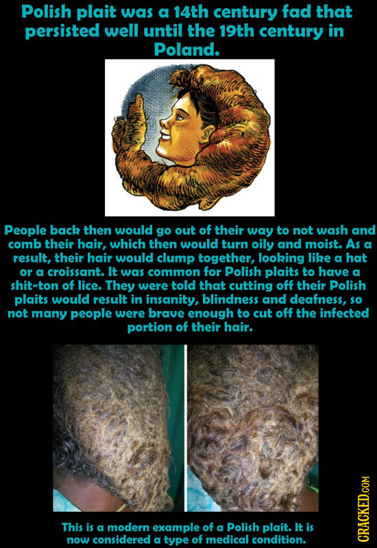 Polish plait was a 14th century fad that persisted well until the 19th century in Poland. People back then would go out of their way to not wash and c