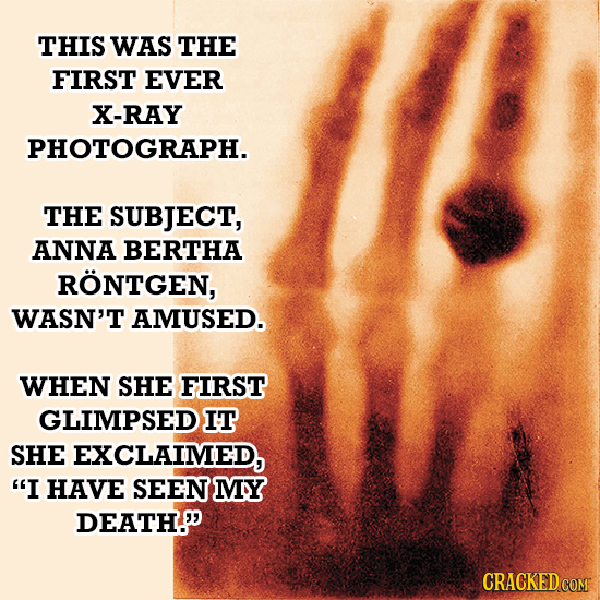 THIS WAS THE FIRST EVER X-RAY PHOTOGRAPH. THE SUBJECT, ANNA BERTHA RONTGEN, WASN'T AMUSED. WHEN SHE FIRST GLIMPSED IT SHE EXCLAIMED, I HAVE SEEN MY D