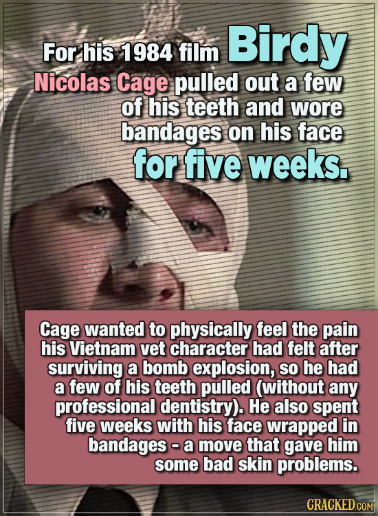 15 WTF Things Actors Did For Their Art - For his 1984 film Birdy, Nicolas Cage pulled out a few of his teeth and wore bandages on his face for five we