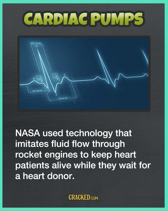 CARDIAC PUMPS peoong NASA used technology that imitates fluid flow through rocket engines to keep heart patients alive while they wait for a heart don