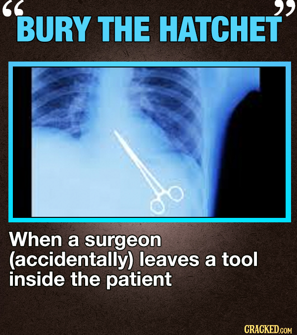 BURY THE HATCHET When a surgeon (accidentally) leaves a tool inside the patient CRACKED.COM 