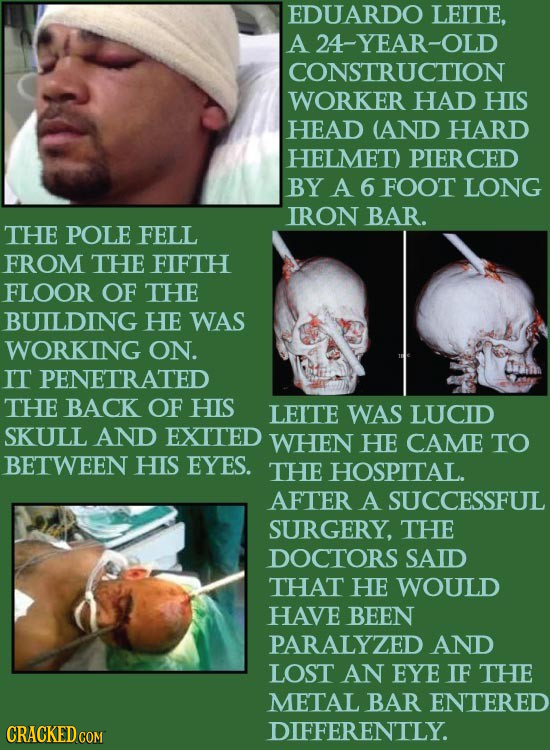 EDUARDO LEITE, A 24-YEAR-OLD CONSTRUCTION WORKER HAD HIS HEAD (AND HARD HELMET) PIERC BY A 6 FOOT LONG IRON BAR. THE POLE FELL FROM THE FIFTH FLOOR OF