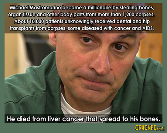 Michael Mastromarinol became a millionaire by stealing bones, organ tissue and other body parts from more than 1,200 corpses. About 000 patients unkno