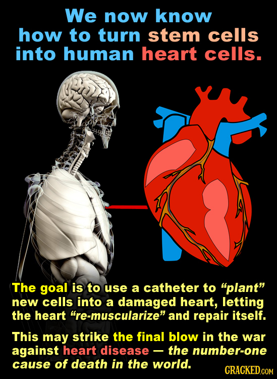 We now know how to turn stem cells into human heart cells. The goal is to use a catheter to plant new cells into a damaged heart, letting the heart