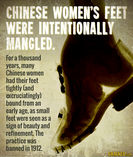 CHINESE WOMEN'S FEET WERE INTENTIONALLY MANGLED. For a thousand years, many Chinese women had their feet tightly (and excruciatingly) bound from an ea
