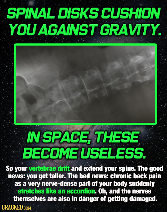 SPINAL DISKS CUSHION YOU AGAINST GRAVITY. IN SPACE, THESE BECOME USELESS. So your vertebrae drift and extend your spine. The good news: you get taller