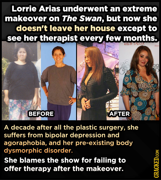 Lorrie Arias underwent an extreme makeover on The Swan, but now she doesn't leave her house except to see her therapist every few months. 1605 DUN gg 