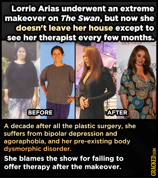 Lorrie Arias underwent an extreme makeover on The Swan, but now she doesn't leave her house except to see her therapist every few months. 1605 DUN gg