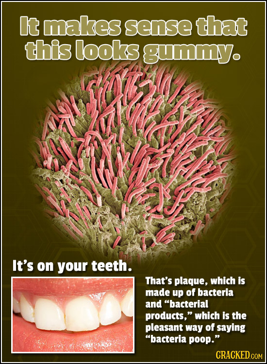 It makes sense that this looks gummy. It's on your teeth. That's plaque, which is made up of bacteria and bacterial products, which is the pleasant 
