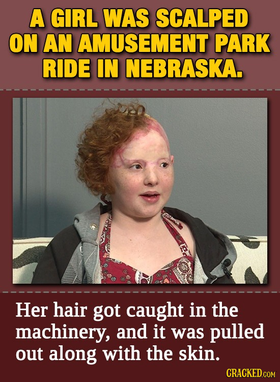 A GIRL WAS SCALPED ON AN AMUSEMENT PARK RIDE IN NEBRASKA. Ct Her hair got caught in the machinery, and it was pulled out along with the skin.