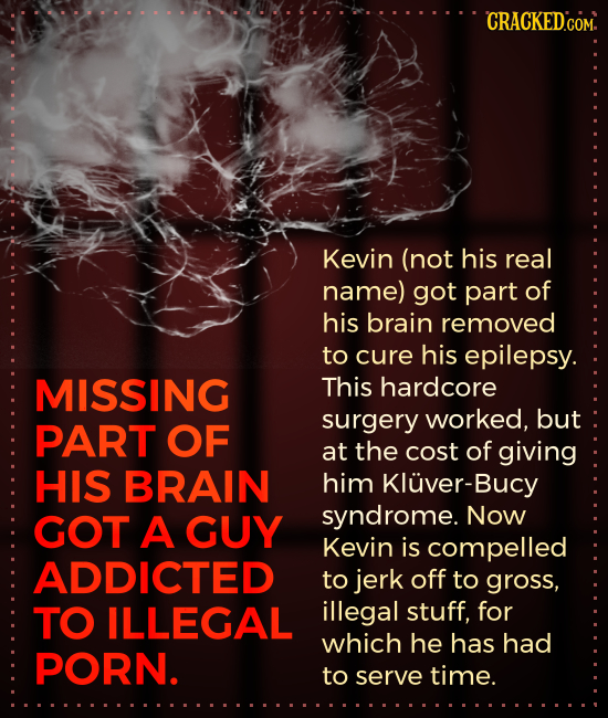 CRACKEDCOM. Kevin (not his real name) got part of his brain removed to cure his epilepsy. MISSING This hardcore surgery worked, but PART OF at the cos