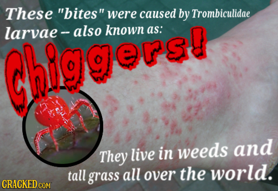 These bites were caused by Trombiculidae larvae also known as: higgersg and They live in weeds tall world. grass all over the CRACKED COM 