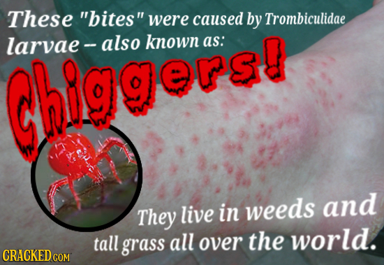 These bites were caused by Trombiculidae larvae also known as: higgersg and They live in weeds tall world. grass all over the CRACKED COM