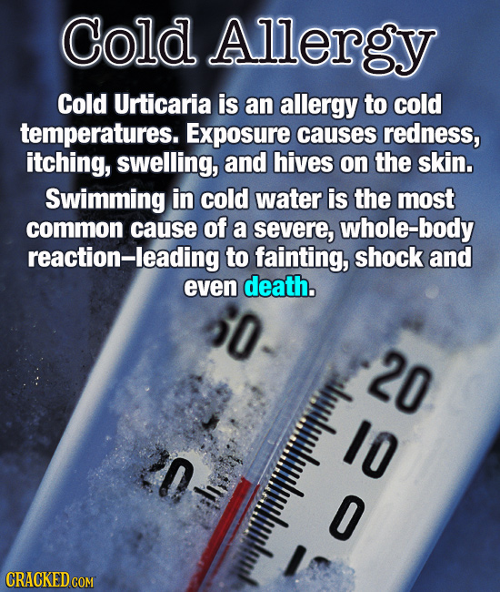 Cold Allergy Cold Urticaria is an allergy to cold temperatures. Exposure causes redness, itching, swelling, anD hives on the skin. Swimming in cold wa