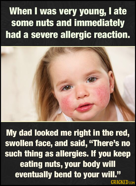 When was very young, I ate some nuts and immediately had a severe allergic reaction. My dad looked me right in the red, swollen face, and said, There