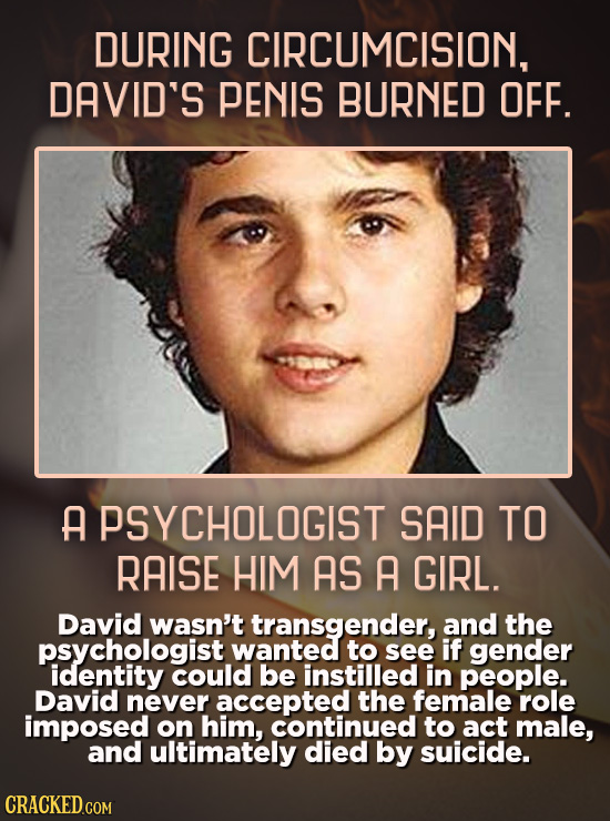 DURING CIRCUMCISION, DAVID'S PENIS BURNED OFF. A PSYCHOLOGIST SAID TO RAISE HIM AS A GIRL. David wasn't transgender, and the psychologist wanted to se