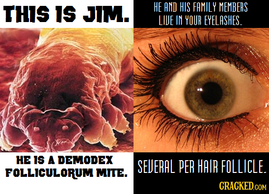 THIS IS JIM. HE AND HIS FAMILY MEMBERS LIUE IN YOUR EYELASHES. HE Is A DEMODEX SEUERAL PER HAIR FOLLICLE. FOLLICULORUM MITE.