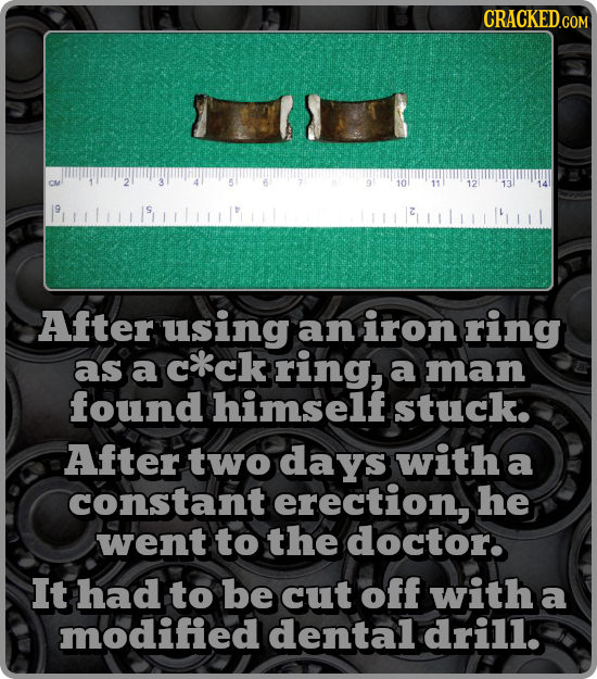 B 10 12 After using an iron ring as a c*ck ring, a man found himself stuck. After two days with a constant erection, he went to the doctor. It had to