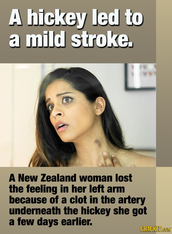 A hickey led to a mild stroke. A New Zealand woman lost the feeling in her left arm because of a clot in the artery underneath the hickey she got a fe