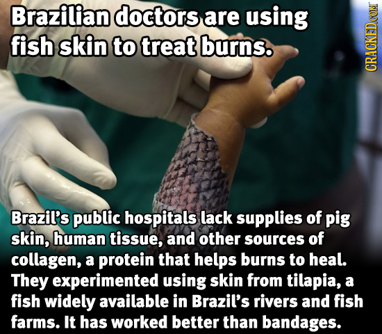 Brazilian doctors are using fish skin to treat burns. CRACKEDCON Brazil's public hospitals lack supplies of pig skin, human tissue, and other sources
