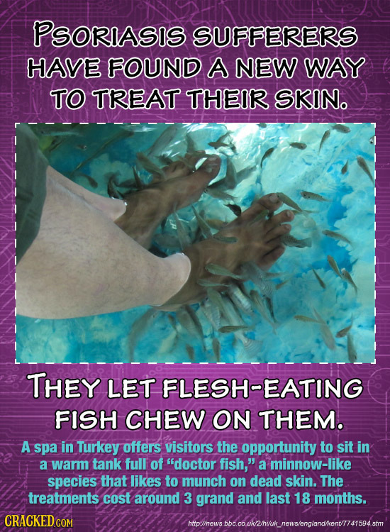 PSORIASIS SUFFERERS HAVE FOUND A NEW WAY TO TREAT THEIR SKIN. THEY LET FLESH-EATING FISH CHEW ON THEM. A spa in Turkey offers visitors the opportunity