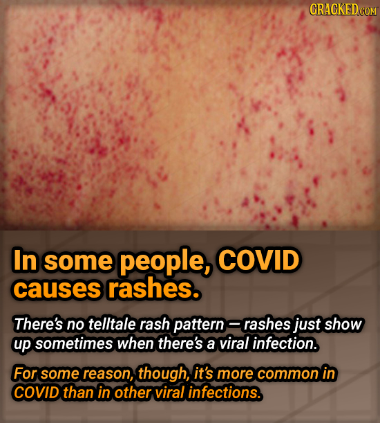 CRACKED COM In some people, COVID causes rashes. There's no telltale rash pattern rashes just show up sometimes when there's a viral infection. For so