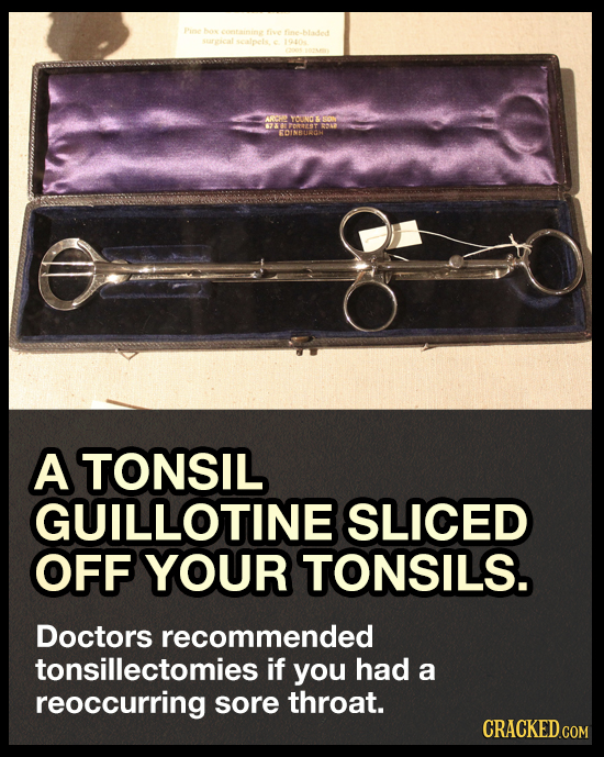 hie /S aVO RDINBUAGH A TONSIL GUILLOTINE SLICED OFF YOUR TONSILS. Doctors recommended tonsillectomies i if you had a reoccurring sore throat. CRACKED.
