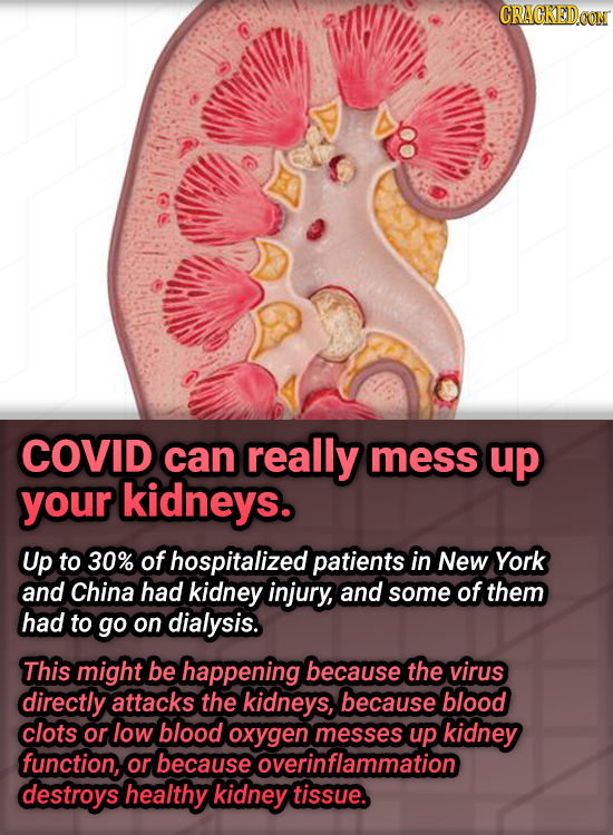 CRACKEDCON COVID can really mess up your kidneys. Up to 30% of hospitalized patients in New York and China had kidney injury, and some of them had to