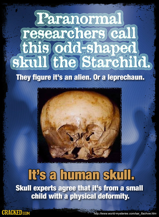 Paranormal researchers call this odd shaped skull the Starchild. They figure it's an alien. Or a leprechaun. It's a human skull. Skull experts agree t