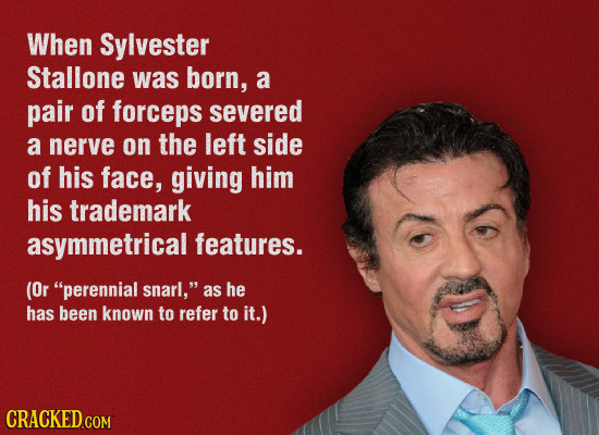 When Sylvester Stallone was born, a pair of forceps severed a nerve on the left side of his face, giving him his trademark asymmetrical features. (Or