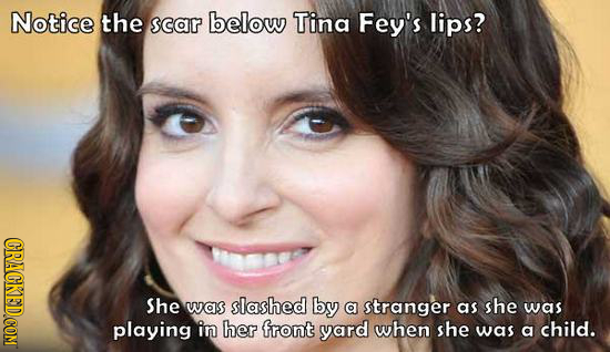 Notice the scar below Tina Fey's lips? She was slashed by a stranger as she was playing in her front yard when she was a child.