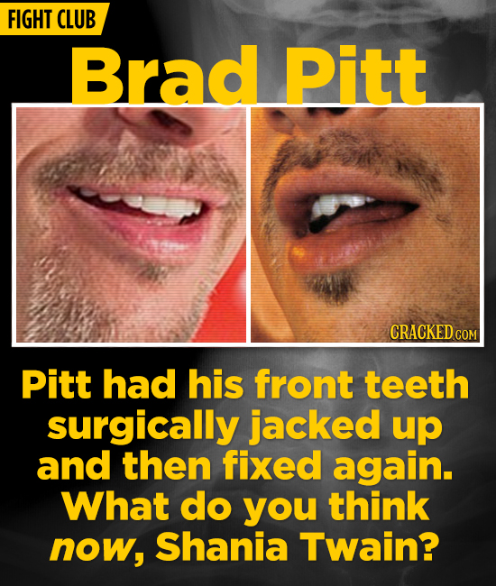 20 Actors Who Jacked Their Bodies Around For Iconic Roles