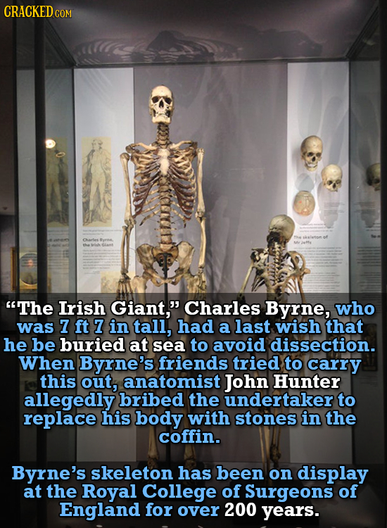 CRACKEDCO COM af Carles rme he The Irish Giant, Charles Byrne, who was 7 ft 7 in tall, had a last wish that he be buried at sea to avoid dissection.