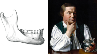 Paul Revere Was… The Nation's First Forensic Dentist? 